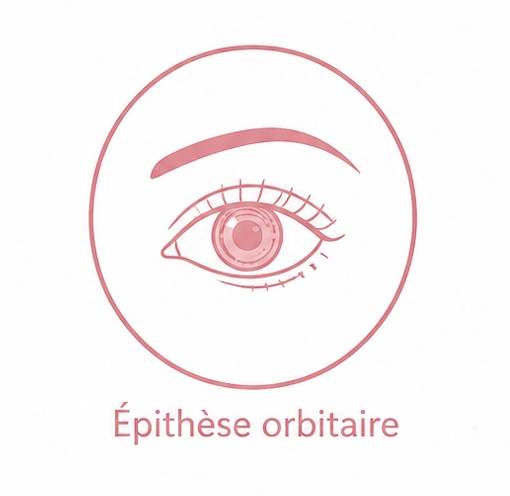 Épithèse orbitaire