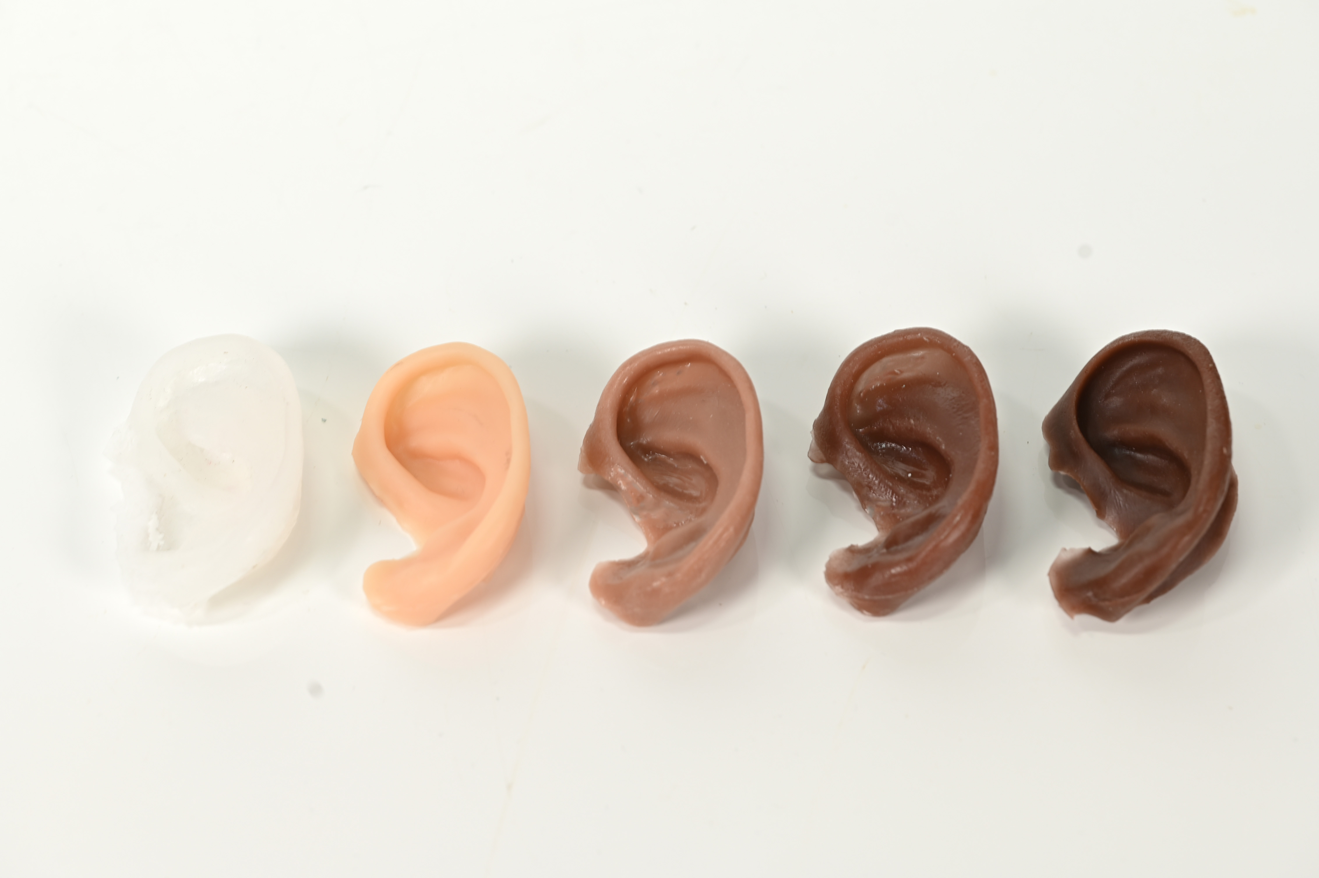 Épithèses auriculaires réalisées sur mesure